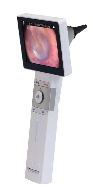 Otoscope Definition: What is Otoscope? (2024)